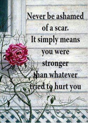 Fuelism #483: Fuelisms : Never be ashamed of a scar. It simply means you were stronger than whatever tried to hurt you.: Fuelisms : Never be ashamed of a scar. It simply means you were stronger than whatever tried to hurt you.